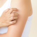 닭살이야 이미지