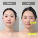 청아피부관리 | [대구/죽전]청아피부체형관리 방문 후기(두골비 안면비대칭 윤곽관리)