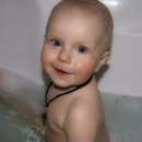 아이피부 이미지