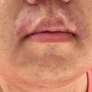 현명기피부과의원 이미지