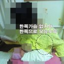 암투병 8년차 한쪽가슴 프로포즈 이후 아기출산 이미지