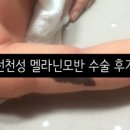 더니버스성형외과의원 네이버블로그