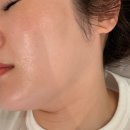 부각뷰티 | 수성구 스킨플래닝 깐달걀 피부결 잘하는 아트뷰티 솔직후기 ft. 토탈뷰티샵