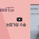 아이원성형외과 재수술 후기, 눈썹거상 자연스러웠어요