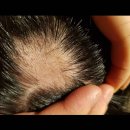 장평주공아파트 2단지 이미지