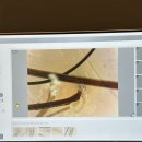 (주)아이골프존 더클래식 | 부산 남포동 두피관리 탈모예방관리 헤솔 두피클리닉스 롯데부산광복점 리얼후기