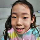 용산제일치과의원 네이버블로그