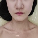 광교피부관리 엘트리움 스킨앤바디에서 G웨이브 윤곽관리 후기