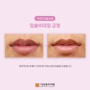 그림성형외과의원 이미지