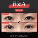 아이컨텍성형외과의원 이미지