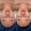 광교 에스테틱 추천 끌레르블랑 열감 싹 내리는 광교 피부관리 후기
