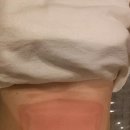 엘리나의원 | 체형클리닉.미쿨 시술후기.다이어트