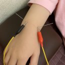 초등 ADHD, 틱 전용 비약물 치료법 5가지(+단약 성공 후기)