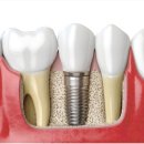 일산스타28치과의원 이미지