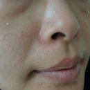 예님피부업!