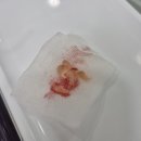평촌STM치과의원 | 범계역 매복사랑니 발치 후기! 턱편한사랑니치과의원 통증 및 솔직 방문기, 주차정보