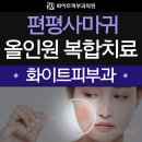 강동피부과 전염시킬 가능성도 있는 사마귀 치료를! 이미지