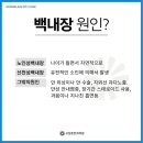고상준안과의원 이미지
