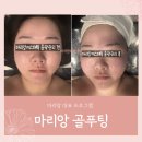 하신골 | 예신 고객님의 리얼 후기 – 영등포신부관리 골푸팅 리프팅