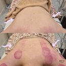 안청남로-2 | [진해 피부관리] 혜리온에스테틱 등관리 후기: 테라노바 에너지로 전신 디톡스까지!