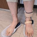소망의수족보조기 이미지