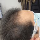 제이피오(J.P.O) | 건대헤드스파케어 나를 위한 힐링타임, 중랑구탈모 후기