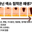 연세익약국 네이버블로그