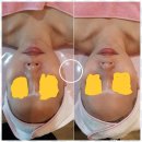 피부천사 네이버블로그