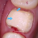 부마치과 이미지