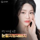 에이탑성형외과의원 | 눈밑지방재배치후기 만족도 높은 에이탑성형외과