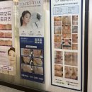 더에이치에스테틱 | 부천에스테틱 부천역 더에이치샵 아쿠아필 모공각질관리기본케어 후기