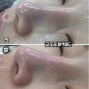 박은영수기관리실 | 안산윤곽관리 잘하는곳 | 안산웨딩관리전문샵 박은영에스테틱 안산피부관리 내돈내산 솔직후기