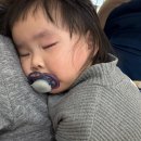 양산안과 | 16개월 아기 눈물샘 막힘 양산부산대학병원 안과 시술 후기
