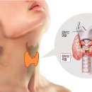 제일보청기 네이버블로그