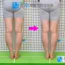 예의원 | 오다리교정후기 오다리교정후기사진 비교의 예 강남수재활의학과 오다리교정병원