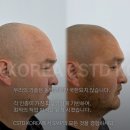 공일공이스튜디오 | 광주삭발두피문신 후기, 잘하는곳의 차이를 결정하는 요소 3가지