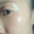 구원2 | 환절기 칙칙한 피부 구원한 더연 기미팩 2주 솔직후기