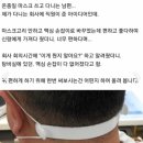 마스크 귀 안아프게 끼는 팁 이미지