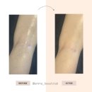 재송한의원 | [재송동/센텀 에스테틱] 하지정맥 다리 마사지