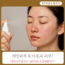 우정의료기기 | 환절기, 예민해진 피부를 위한 새로운 선택[플라즈마활성수]