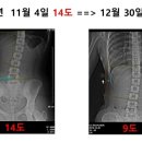 2021년 11월 28일(일) DMC재활운동학회 척추측만증 교정 교육 이미지