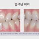 모두의미소치과의원 네이버블로그