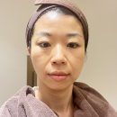 뚜뚜네 미용실 | 뚜뚜의원에서 팔자주름없애기 (+ 내돈내산 비용까지)