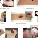 제이엠메디칼 이미지