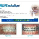 서울탑치과병원 이미지