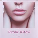 이미자다이어트