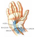 웰신경과의원 | 손목 수근관 증후군, 손목 통증, 신경 통증, 만성통증, 손목 치료 "웰신경과의원" 내돈내산 치료 후기!