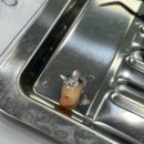 삼성아이비의원 | 고양시 일산 백석역 근처 치과 사랑니 뺀 후기 :: 예쁘게 자란 윗니 사랑니, 마취주사 잘 놔줌, 친절...