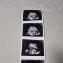 (주)미래앤 | [임신20주차] 벌써반이나 왔어! 크리스마스 &amp; 강남 미래와희망 산부인과 정밀초음파 후기