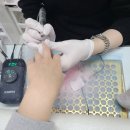 히링네일 이미지